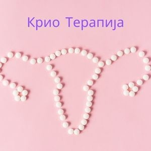 krio-terapija